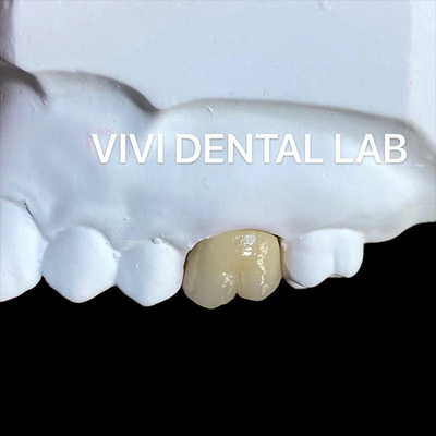 Be Ni Free Металлические фарфоровые короны PFM Crown China Dental Lab