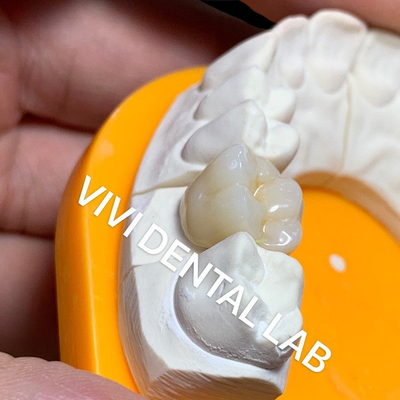 Твердая зубоврачебная лаборатория увенчивает Pro высокий Translucency 3D полный Zirconia увенчивает лабораторию Китая зубоврачебную