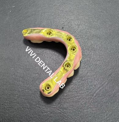 Полный цирконовый мост с титановой стойкой поддержки Китайская стоматологическая лаборатория