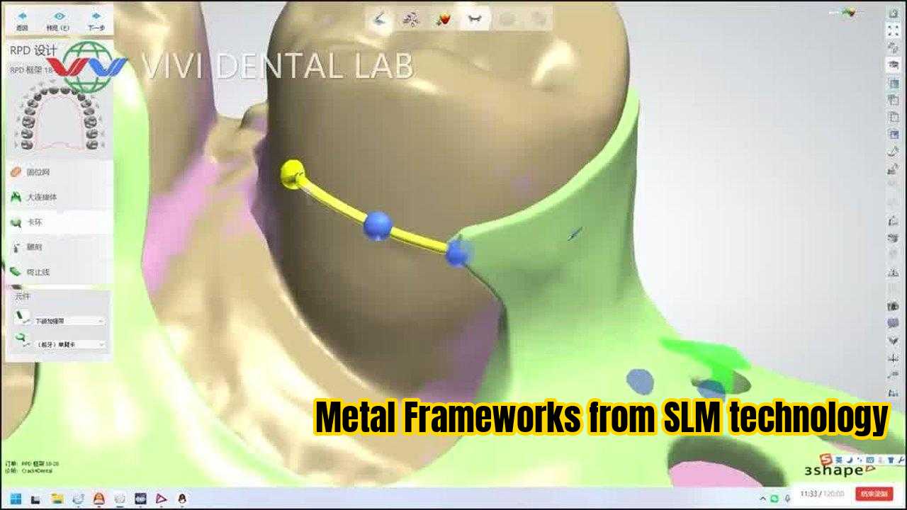 КИТАЙ VIVI DENTAI LABORATORY Сертификаты
