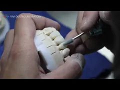 Твердая зубоврачебная лаборатория увенчивает Pro высокий Translucency 3D полный Zirconia увенчивает лабораторию Китая зубоврачебную
